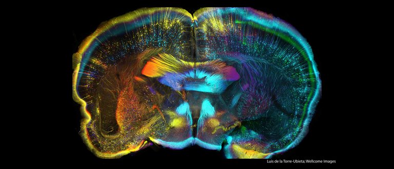 Confocal microscopy of a 750um coronal section of a Thy1-GFP mouse brain that was rendered optically transparent.