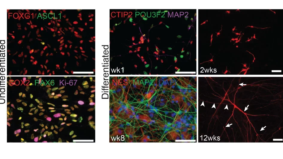Immunocytochemistry of cultured human neural progenitor cells.